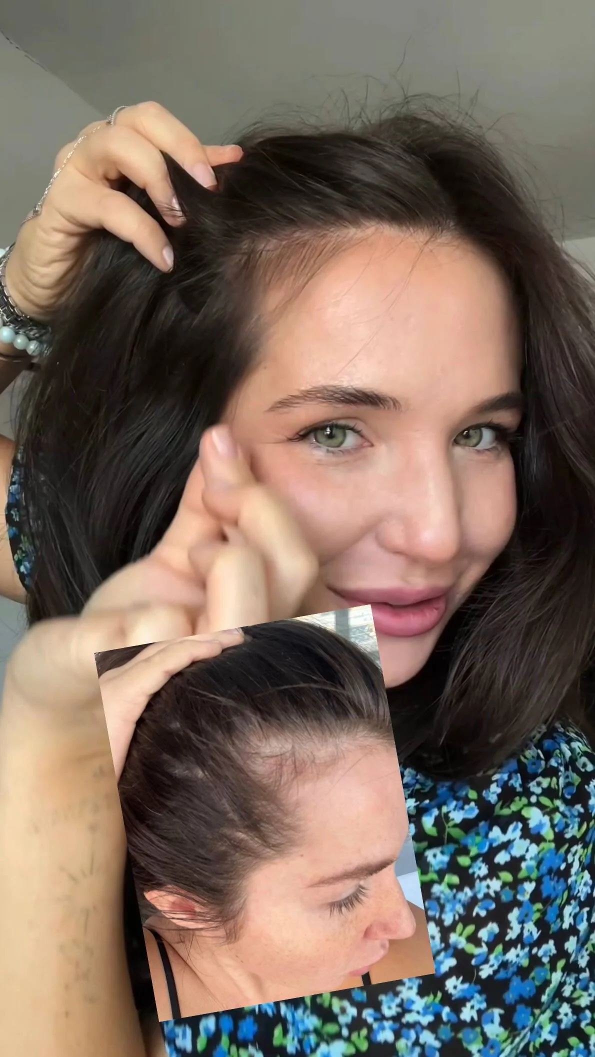 Ампула создана специально для бережной стимуляции роста волос. В составе только натуральные компоненты, которые помогают укрепить корни и активизировать новые волосяные фолликулы. Без гормонов ✅ Без стероидов ✅ ✔️ Средс...